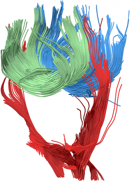 Results of fiber tracking